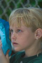 Annie holds an icepack to her eye